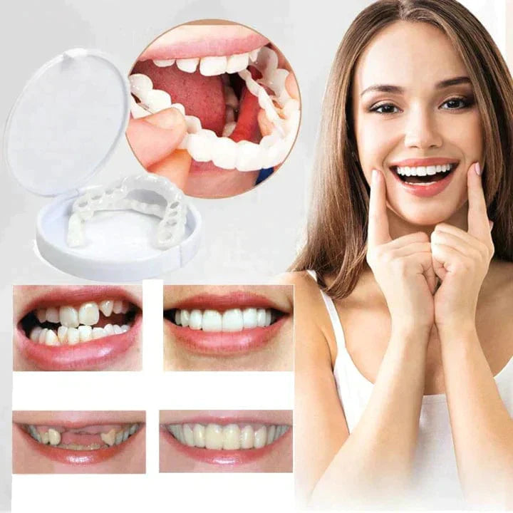 Instant Smile Reusable Snap On Veneers (Upper & Lower)