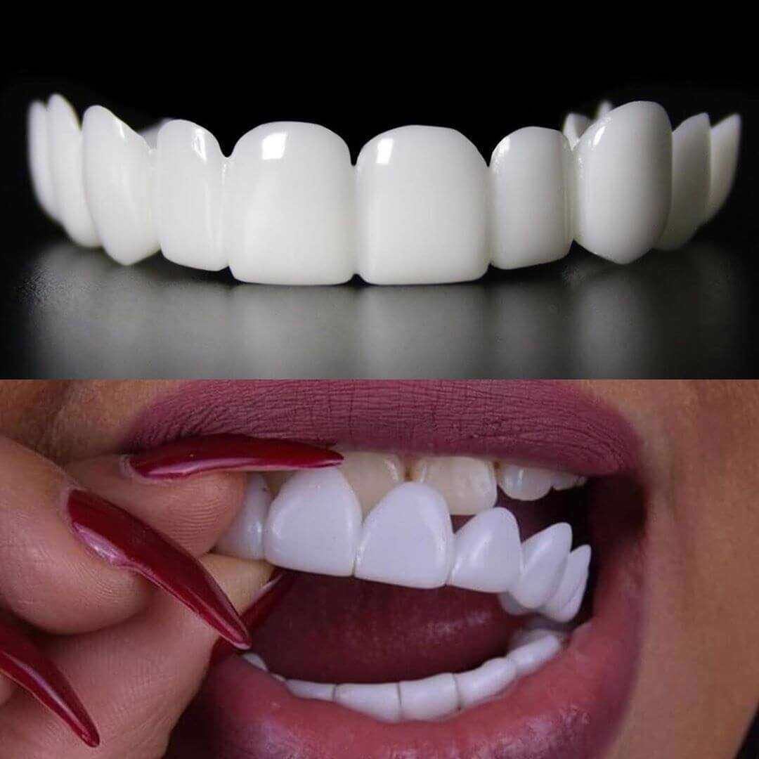 Instant Smile Reusable Snap On Veneers (Upper & Lower)